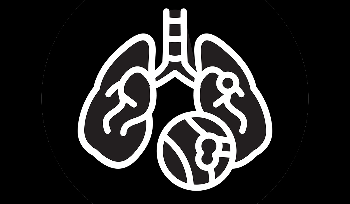 Pulmonary Embolism