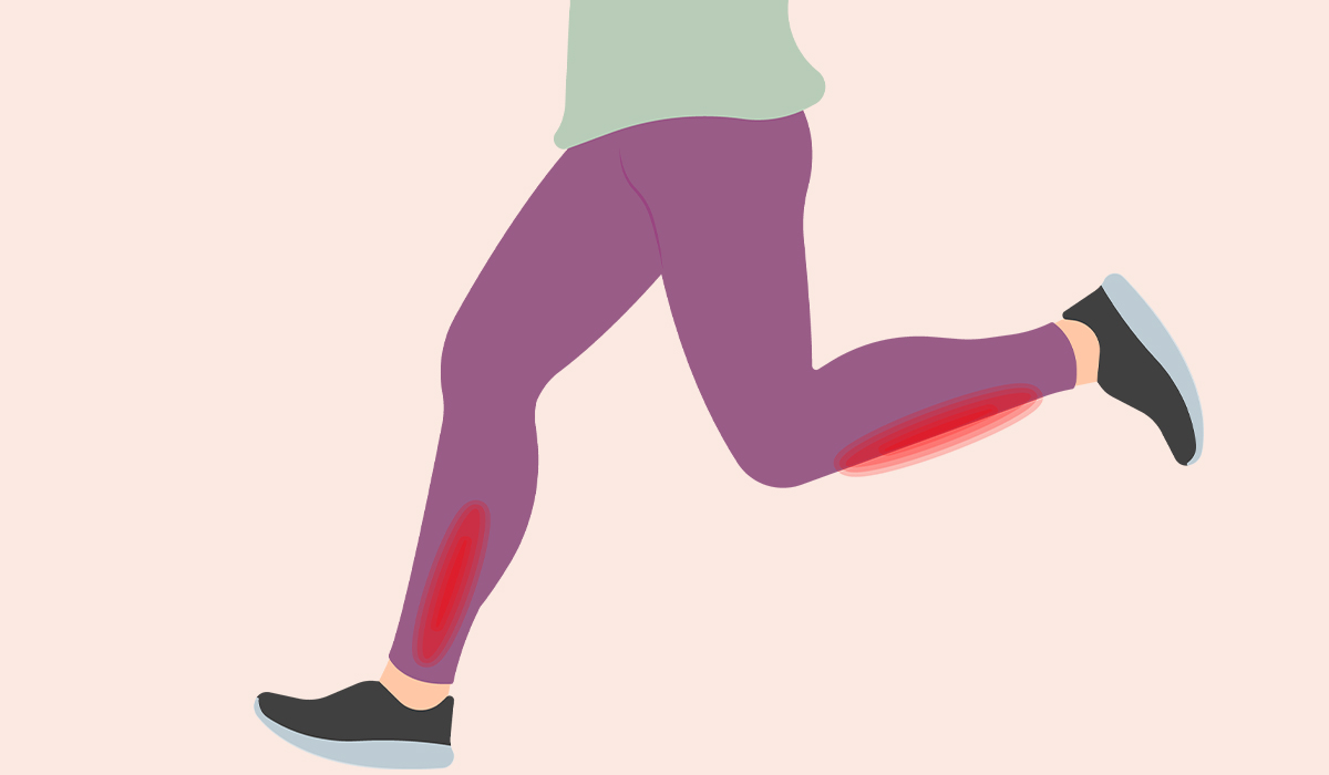 Shin Splints