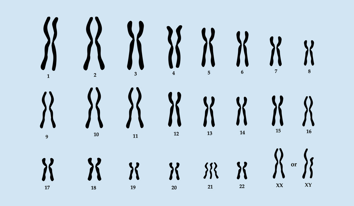Trisomy: What Is, Causes, and The Most Common Trisiomies