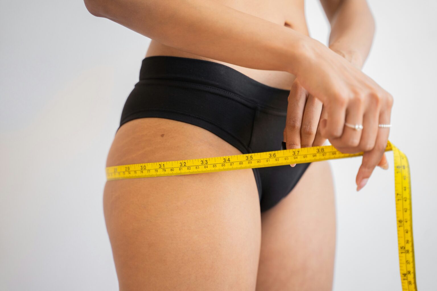 varicose-veins-what-are-causes-symptoms-treatment-and-prevention-647272 varicose-veins-what-are-causes-symptoms-treatment-and-prevention-647272