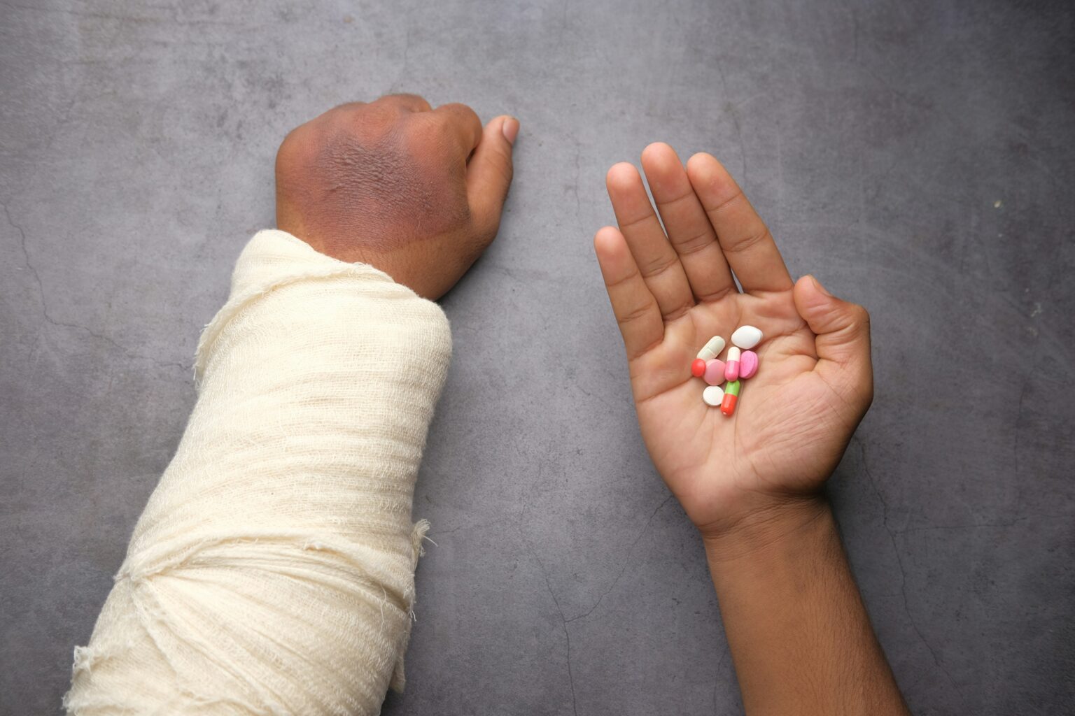 arm-pain-what-is-diagnosis-treatment-and-prognosis-438499 arm-pain-what-is-diagnosis-treatment-and-prognosis-438499
