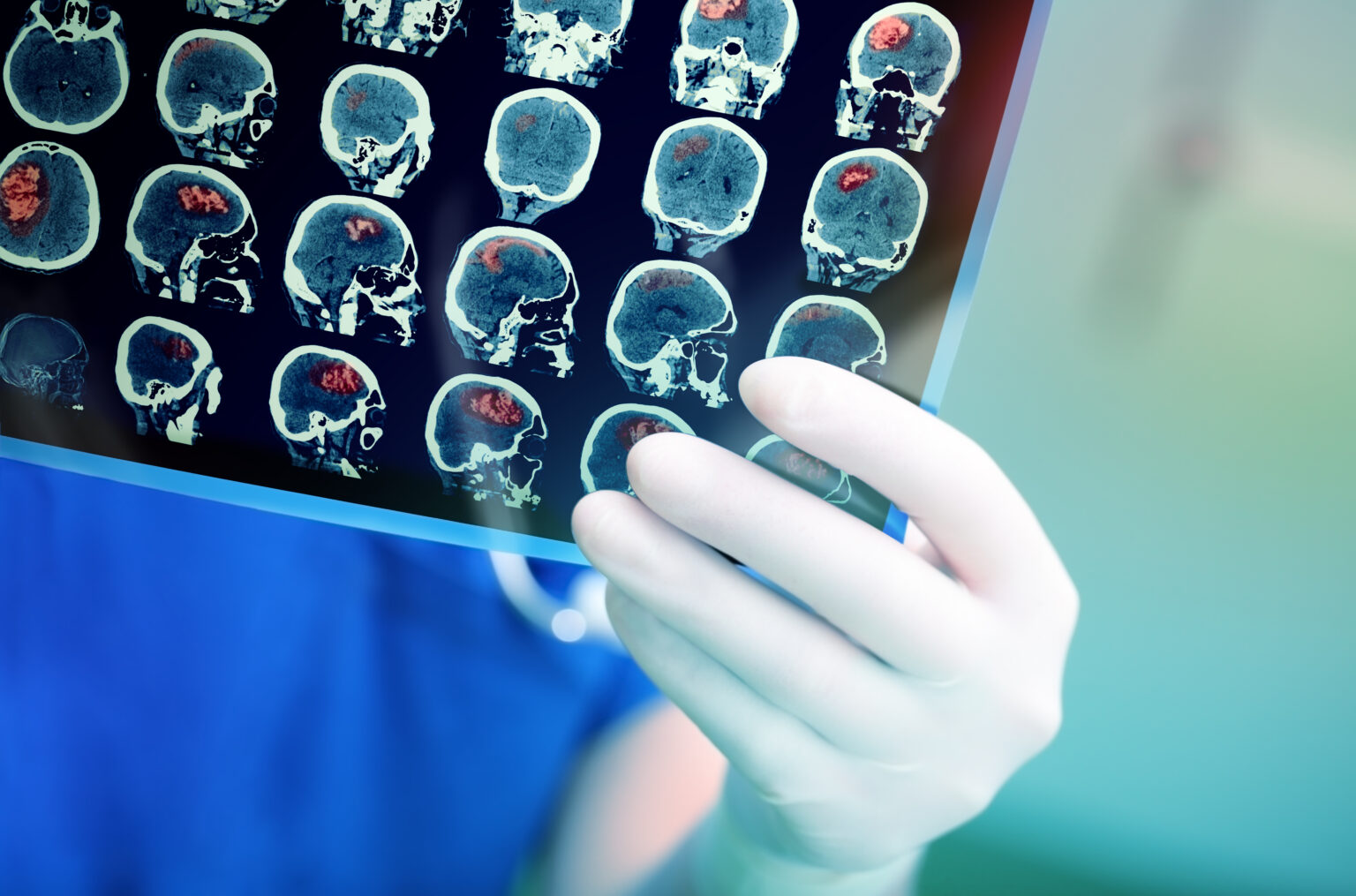 Doctor,Attentively,Examines,The,Mri,Scan,Of,The,Patient. Doctor,Attentively,Examines,The,Mri,Scan,Of,The,Patient.