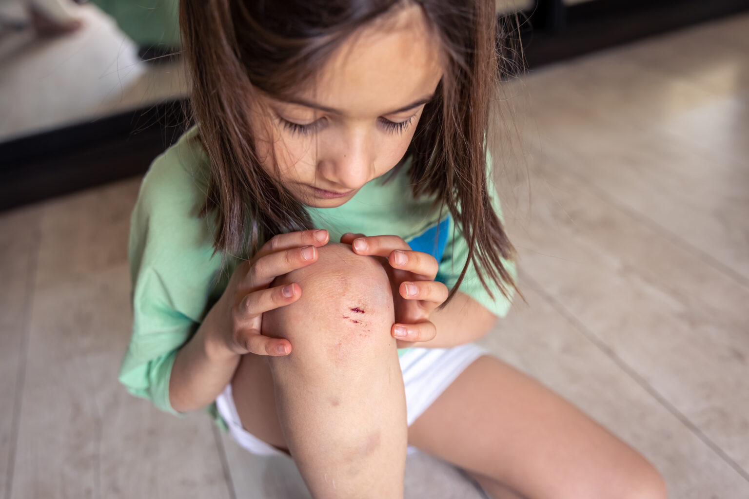 Close-up of little girl holding her bruised injured damaged knee with her hands. Close-up of little girl holding her bruised injured damaged knee with her hands.