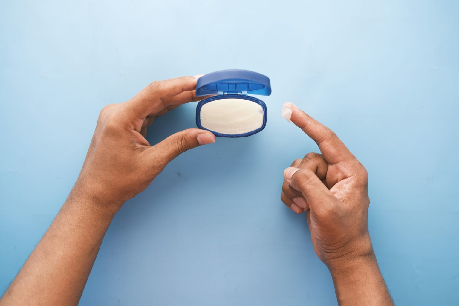 dry-skin-what-is-causes-symptoms-and-treatment-684490 dry-skin-what-is-causes-symptoms-and-treatment-684490