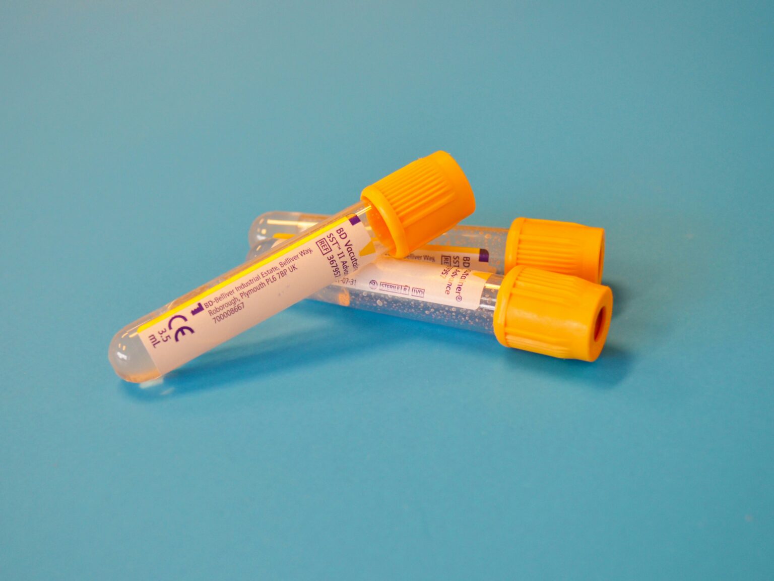 endocrinologist-what-is-the-role-of-diseases-and-diagnostic-methods-547040 endocrinologist-what-is-the-role-of-diseases-and-diagnostic-methods-547040