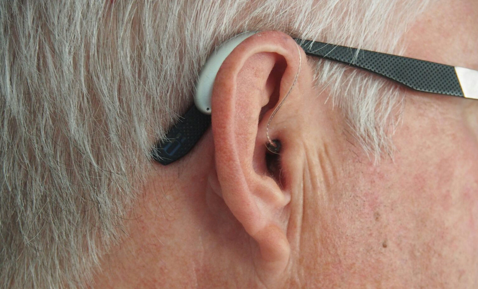 hearing-loss-what-is-types-causes-diagnosis-739518 hearing-loss-what-is-types-causes-diagnosis-739518