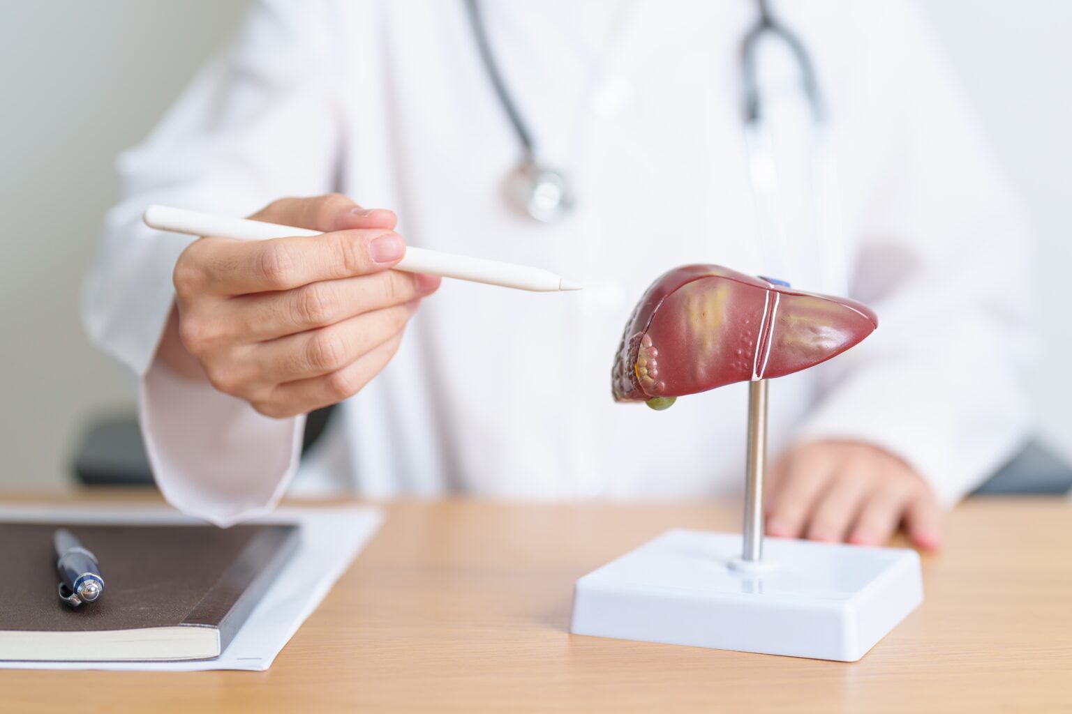 Doctor,With,Human,Liver,Anatomy,Model.,Liver,Cancer,And,Tumor,