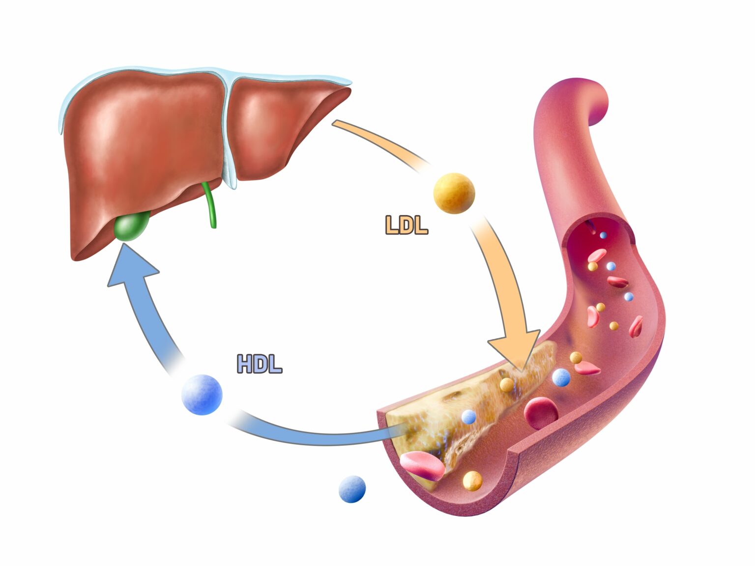 High,Density,And,Low,Density,Lipoproteins,Adding,And,Removing,Cholesterol High,Density,And,Low,Density,Lipoproteins,Adding,And,Removing,Cholesterol