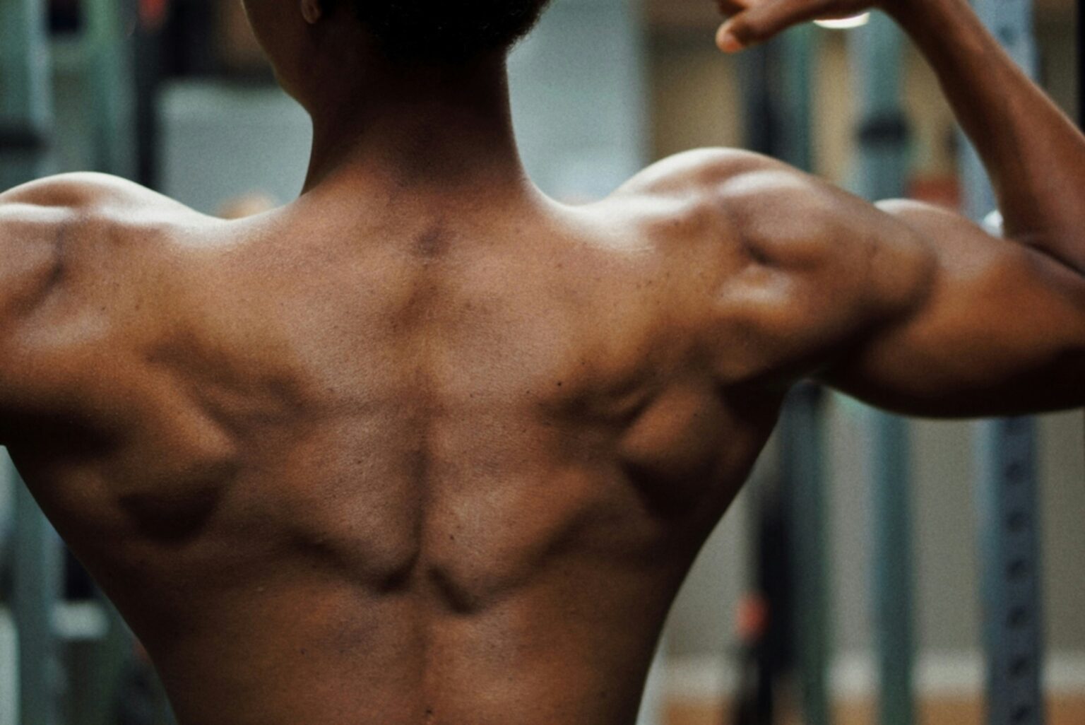 muscle-pain-what-is-symptoms-diagnosis-and-treatment-357809
