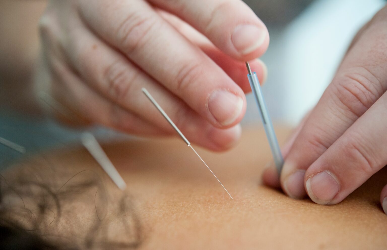neck-pain-what-is-symptoms-diagnosis-and-treatment-666288 neck-pain-what-is-symptoms-diagnosis-and-treatment-666288
