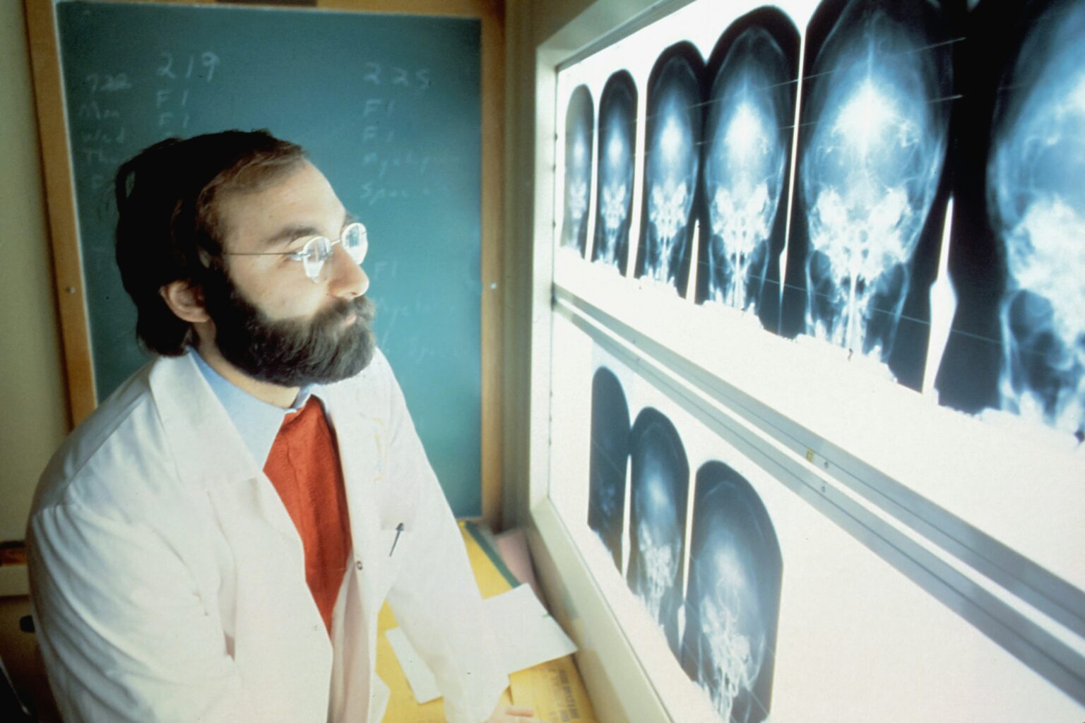 x-ray-what-is-history-uses-procedure-contrasting-and-risk-136900 x-ray-what-is-history-uses-procedure-contrasting-and-risk-136900