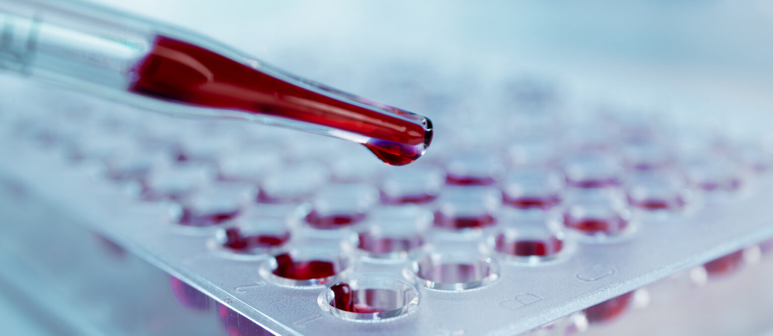 blood-types-what-are-the-rh-system-inheritance-408342 blood-types-what-are-the-rh-system-inheritance-408342