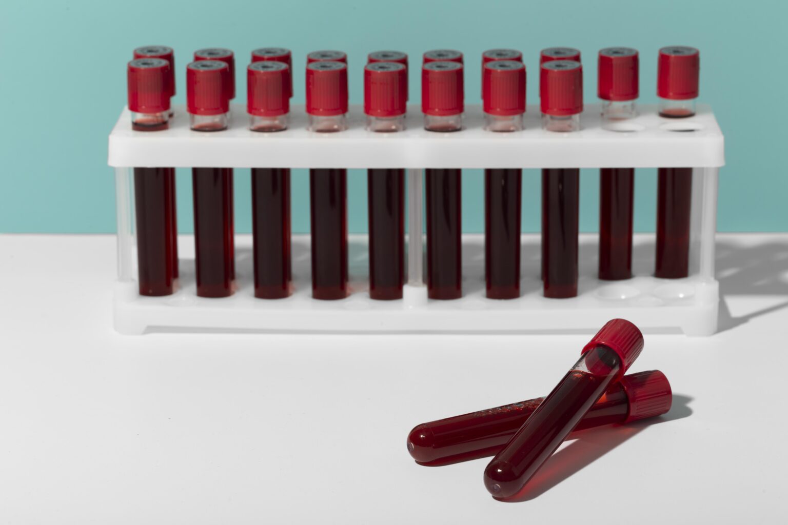 blood-types-what-are-the-rh-system-inheritance-713034 blood-types-what-are-the-rh-system-inheritance-713034