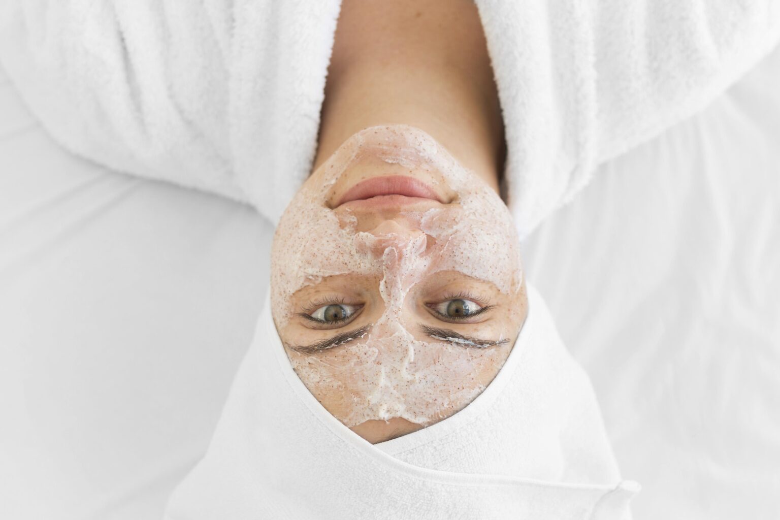 freckles-what-are-causes-formation-removal-829000 freckles-what-are-causes-formation-removal-829000