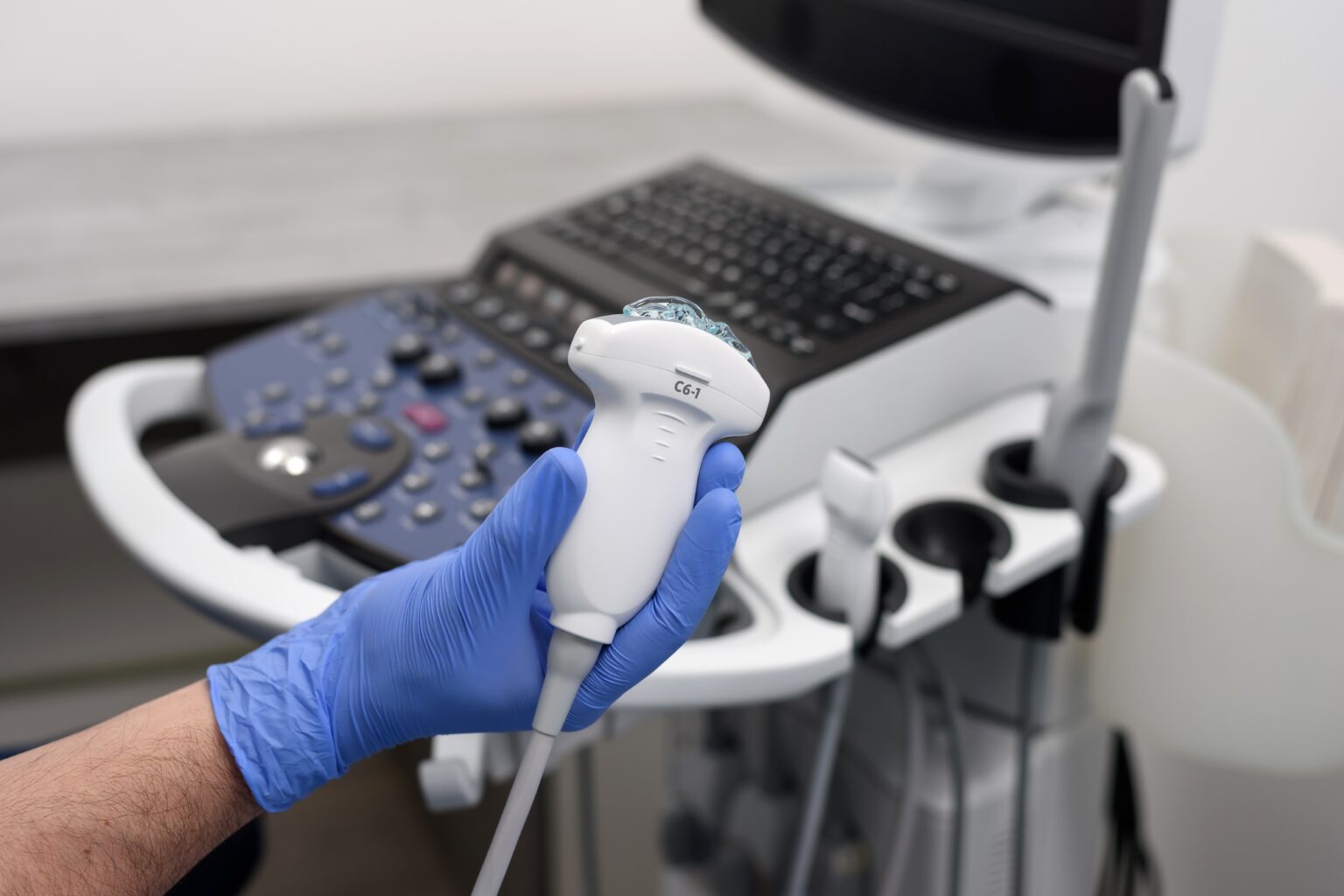 Probe,For,Ultrasound,Diagnostics,Close-up.,The,Doctor,Holds,In,His Probe,For,Ultrasound,Diagnostics,Close-up.,The,Doctor,Holds,In,His