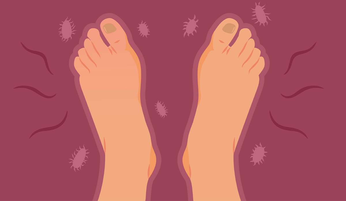 Toenail Fungus