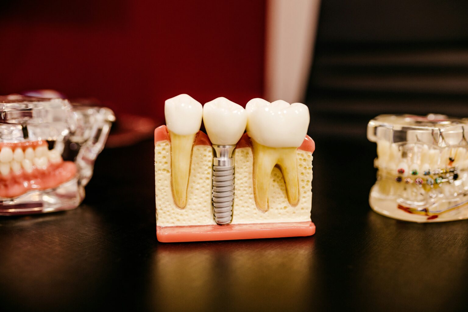 tooth-pain-what-is-diagnosis-treatment-and-prognosis-159345 tooth-pain-what-is-diagnosis-treatment-and-prognosis-159345