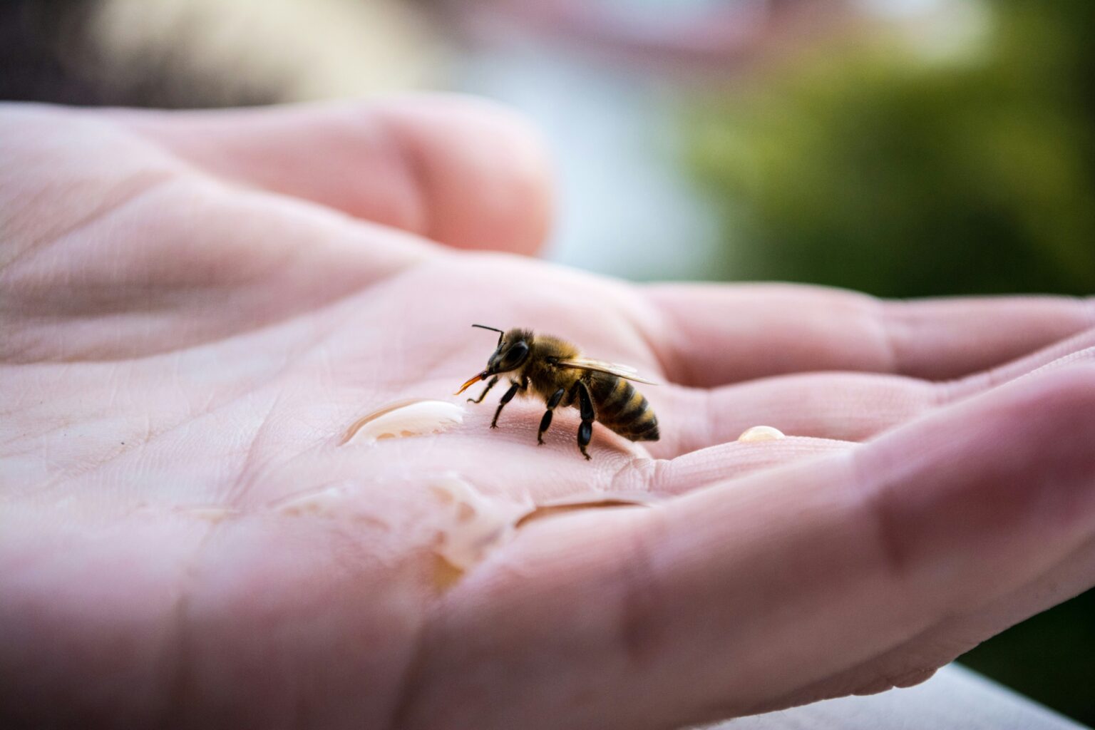 bee-sting-what-is-causes-diagnosis-and-treatment-059188 bee-sting-what-is-causes-diagnosis-and-treatment-059188
