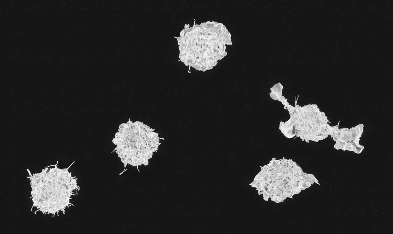 eosinophils-what-are-signs-complications-and-treatment-155641