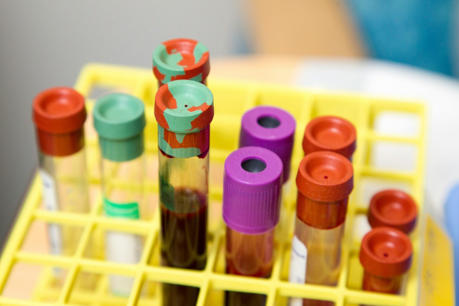 white-blood-cells-what-are-functions-health-problems-and-diagnosis-430508 white-blood-cells-what-are-functions-health-problems-and-diagnosis-430508