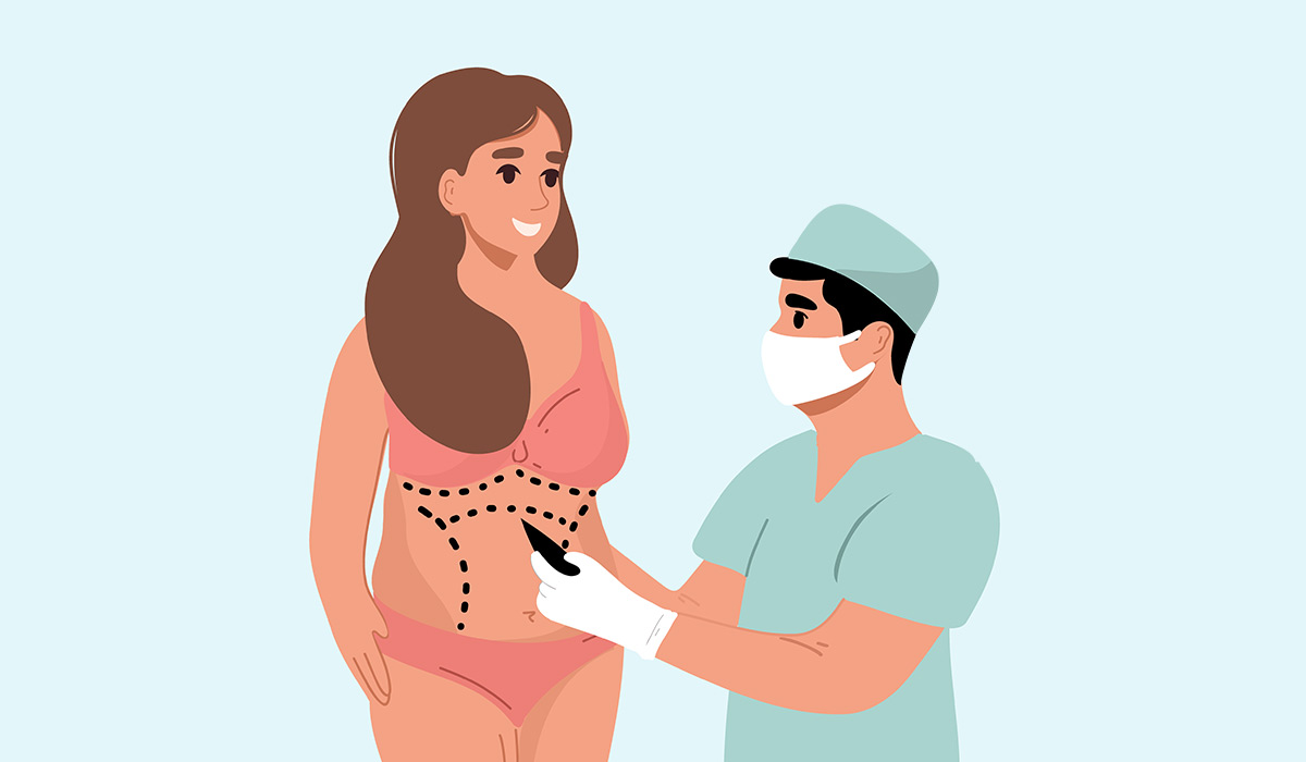 Liposuction: What Is, Procedure, Indications, and Contraindications