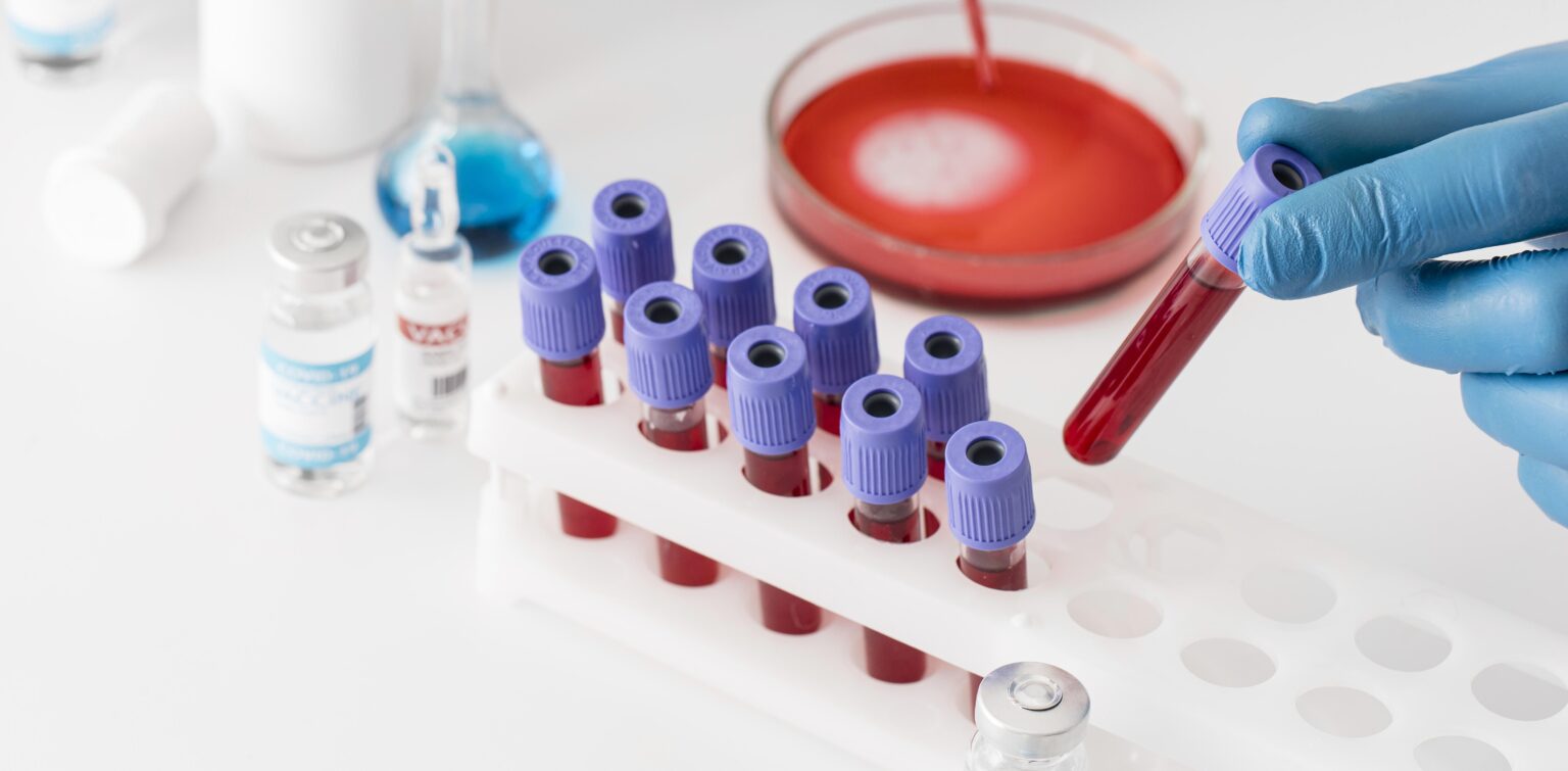 coronavirus-vaccine-lab-with-samples coronavirus-vaccine-lab-with-samples