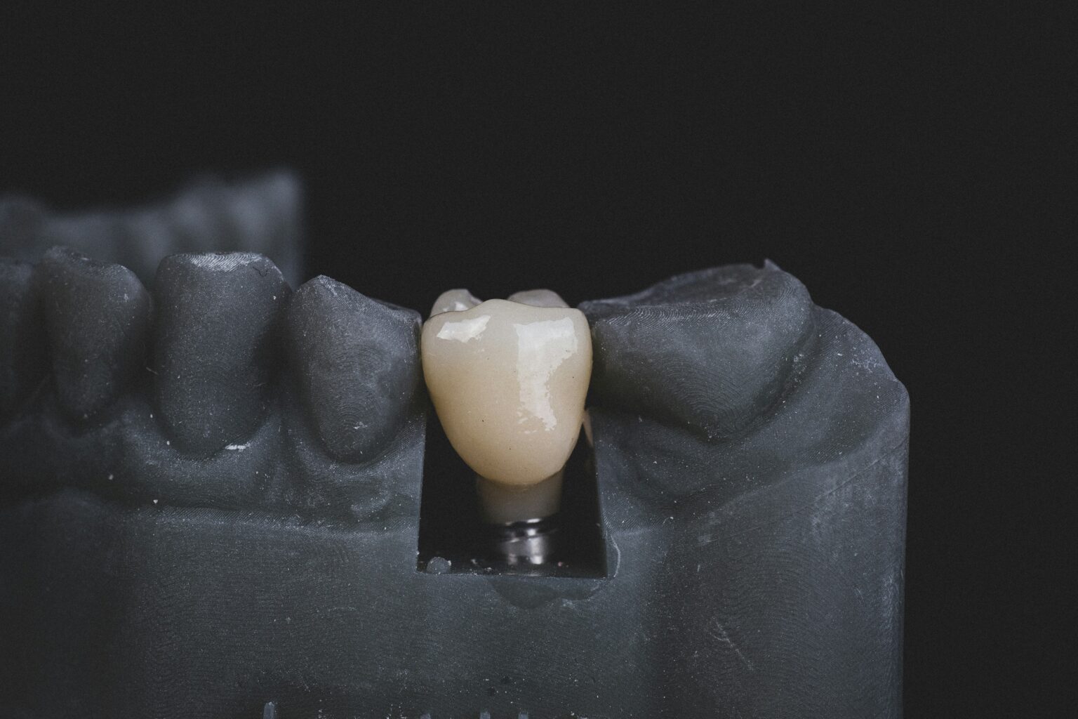 bogdan-condr-q1KLbswF70Y-unsplash bogdan-condr-q1KLbswF70Y-unsplash